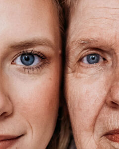 Envejecimiento de la piel